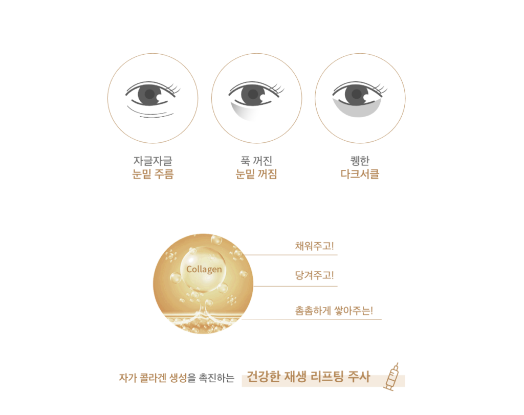 eyekong 1